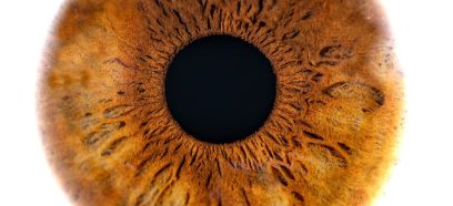 Auge